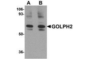 Western blot analysis of GOLPH2 in rat brain tissue lysate with AP30371PU-N GOLPH2 antibody at (A) 0. (GOLM1 antibody  (Center))