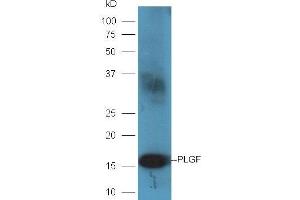 Rat placenta lysates probed with Rabbit Anti-PLGF Polyclonal Antibody, Unconjugated (ABIN727220) at 1:300 overnight at 4 °C. (PLGF antibody  (AA 101-158))