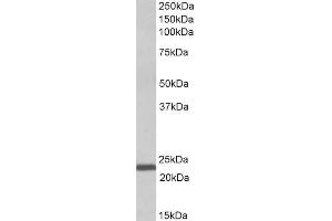 ABIN5539545 (1µg/ml) staining of Human Bone Marrow lysate (35µg protein in RIPA buffer). (IL-15 antibody  (AA 70-82))