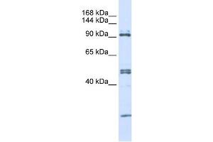 AARS antibody used at 1 ug/ml to detect target protein. (AARS antibody  (N-Term))