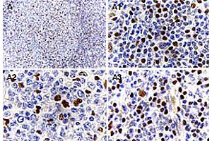 Immunohistochemical analysis of MALT1 expression in formalin-fixed human reactive lymph node. (MALT1 antibody)