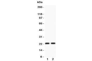 Western blot testing of CD3 epsilon antibody and Lane 1:  Jurkat (CD3 epsilon antibody  (AA 23-207))