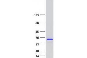 CCDC90B Protein (Myc-DYKDDDDK Tag)