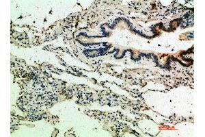 Immunohistochemical analysis of paraffin-embedded human-lung, antibody was diluted at 1:200 (THBS4 antibody  (AA 551-600))