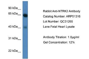 WB Suggested Anti-NTRK2  Antibody Titration: 0.