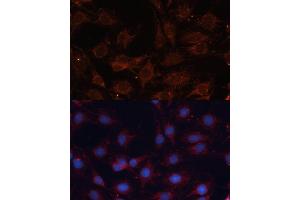 Immunofluorescence analysis of C6 cells using SLC25 antibody (ABIN6132661, ABIN6147921, ABIN6147922 and ABIN6215721) at dilution of 1:100. (SLC25A24 antibody  (AA 1-200))