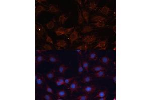 Immunofluorescence analysis of C6 cells using SLC25 antibody (ABIN6132661, ABIN6147921, ABIN6147922 and ABIN6215721) at dilution of 1:100. (SLC25A24 antibody  (AA 1-200))