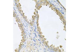 Immunohistochemistry of paraffin-embedded human prostate using HSP90AA1 antibody (ABIN6292998) at dilution of 1:100 (40x lens).