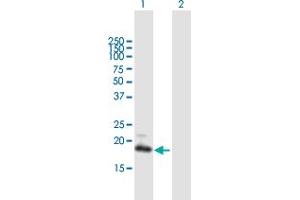 Western Blot analysis of GUCA1C expression in transfected 293T cell line by GUCA1C MaxPab polyclonal antibody. (GUCA1C antibody  (AA 1-209))