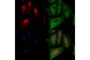 ABIN6263779 and ABIN6279623 staining  cells by IF/ICC. (NUP88 antibody  (Internal Region))