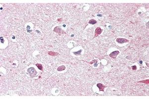 Detection of HEXb in Human Cerebrum Tissue using Polyclonal Antibody to Hexosaminidase B Beta (HEXb) (HEXB antibody  (AA 101-217))