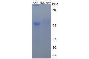 Image no. 1 for Neuromedin U (NMU) peptide (Ovalbumin) (ABIN5666293) (Neuromedin U (NMU) peptide (Ovalbumin))
