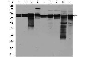 Western blot analysis using EIF4B mouse mAb against A549 (1), A431 (2), HepG2 (3), HEK293 (4), HeLa (5), Jurkat (6), K562 (7), NIH3T3 (8), and MCF-7 (9) cell lysate.