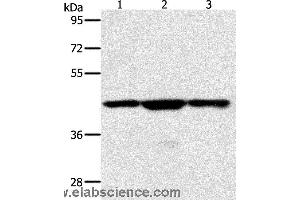 Western blot analysis of Jurkat, hela and K562 cell, using MAP2K1 Polyclonal Antibody at dilution of 1:400 (MEK1 antibody)