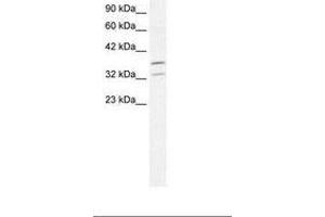 Image no. 1 for anti-Forkhead Box L1 (FOXL1) (N-Term) antibody (ABIN202292) (FOXL1 antibody  (N-Term))