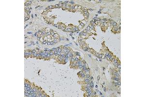 Immunohistochemistry of paraffin-embedded human prostate using ALDH3A1 Antibody (ABIN6290003) at dilution of 1:100 (40x lens).