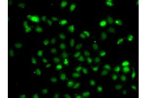 Immunofluorescence analysis of A549 cell using BCL6 antibody. (BCL6 antibody)