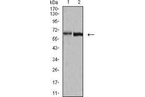 Western blot analysis using VP2 mouse mAb against A431 (1) and BCBL-1 (2) cell lysate. (VP2 (AA 296-438) antibody)