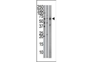 The anti-Importin alpha-3 Pab (ABIN388688 and ABIN2838720) is used in Western blot to detect Importin alpha-3 in Hela (left), mouse brain (middle), and HepG2 (right)cell line/tissue lysates.