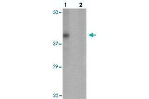 Western blot analysis of RNASET2 in SW480 cell lysate with RNASET2 polyclonal antibody  at 1 ug/mL in (lane 1) the absence and (lane 2) the presence of blocking peptide.