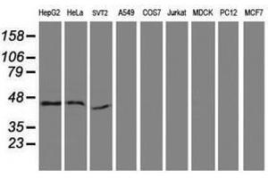 Image no. 2 for anti-serpin Peptidase Inhibitor, Clade B (Ovalbumin), Member 13 (SERPINB13) antibody (ABIN1500879) (SERPINB13 antibody)
