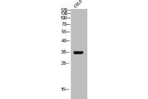 Western Blot analysis of COLO cells using GPR119 Polyclonal Antibody (G Protein-Coupled Receptor 119 antibody  (Internal Region))