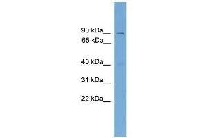 WB Suggested Anti-Aste1 Antibody Titration:  0.