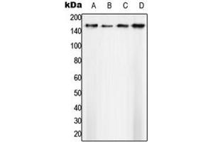 Western blot analysis of SAP155 expression in A431 (A), Ramos (B), SP2/0 (C), H9C2 (D) whole cell lysates.