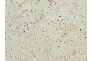Immunohistochemistry of paraffin-embedded human colon tissue using ABIN7161250 at dilution of 1:100 (NBPF3 antibody  (AA 1-252))