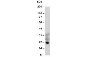 Western blot testing of FGF4 antibody and HeLa cell lysate