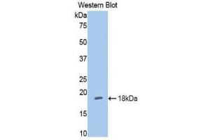 Western Blotting (WB) image for anti-Hexokinase 1 (HK1) (AA 676-800) antibody (ABIN1859173) (Hexokinase 1 antibody  (AA 676-800))