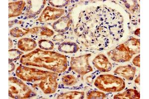 Immunohistochemistry of paraffin-embedded human kidney tissue using ABIN7152544 at dilution of 1:100 (FANCC antibody  (AA 1-210))