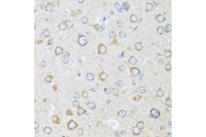 Immunohistochemistry (IHC) image for anti-BR Serine/threonine Kinase 1 (BRSK1) (AA 310-510) antibody (ABIN7265908)