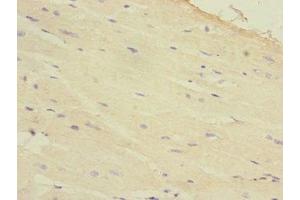 Immunohistochemistry of paraffin-embedded human heart tissue using ABIN7154845 at dilution of 1:100 (HAND1 antibody  (AA 16-215))