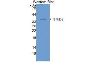 Western blot analysis of the recombinant protein. (MGLL antibody  (AA 1-303))