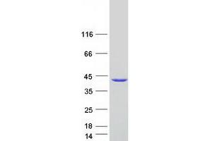 Western Blotting (WB) image for StAR-Related Lipid Transfer (START) Domain Containing 7 (STARD7) (Transcript Variant 2) protein (Myc-DYKDDDDK Tag) (ABIN2732770)