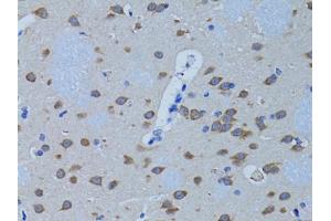 Immunohistochemistry of paraffin-embedded rat brain using PLCB1 antibody (ABIN1874160) at dilution of 1:100 (40x lens). (Phospholipase C beta 1 antibody)