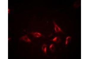 Immunofluorescent analysis of BCLG staining in Hela cells. (BCL2L14 antibody)