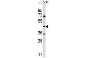 ASS1 Antibody (C-term) western blot analysis in Jurkat cell line lysates (35µg/lane).