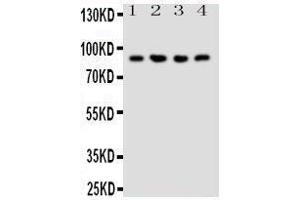 Western Blotting (WB) image for anti-Neuregulin 2 (NRG2) (AA 289-306), (Middle Region) antibody (ABIN3044233) (Neuregulin 2 antibody  (Middle Region))