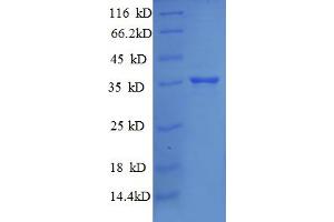 SDS-PAGE (SDS) image for Ribosomal Protein S18 (RPS18) (AA 2-75) protein (GST tag) (ABIN5712602)