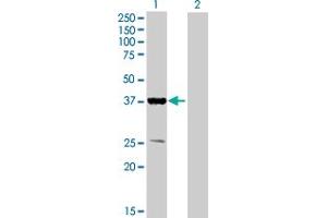 Western Blot analysis of PPP1R3B expression in transfected 293T cell line by PPP1R3B MaxPab polyclonal antibody. (PPP1R3B antibody  (AA 1-285))