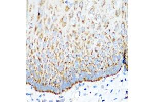Immunohistochemistry of paraffin-embedded human esophagus using MT-CO2 antibody (ABIN4903355) at dilution of 1:100 (40x lens). (COX2 antibody)