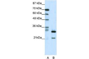 WB Suggested Anti-HMOX2 Antibody Titration: 0. (HMOX2 antibody  (N-Term))