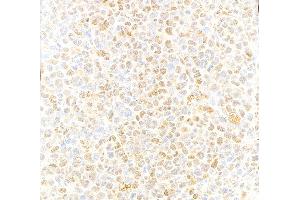 Immunohistochemistry (IHC) image for anti-Valosin Containing Protein (VCP) (C-Term) antibody (ABIN7452151) (VCP antibody  (C-Term))