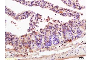 Formalin-fixed and paraffin embedded mouse intestine labeled with Anti-MICA/MHC I a Polyclonal Antibody, Unconjugated (ABIN728788) at 1:200 followed by conjugation to the secondary antibody and DAB staining. (MICA antibody  (AA 120-170))