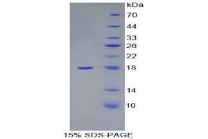 SDS-PAGE (SDS) image for Desert Hedgehog (DHH) (AA 241-383) protein (His tag) (ABIN2121218) (desert Hedgehog Protein (AA 241-383) (His tag))