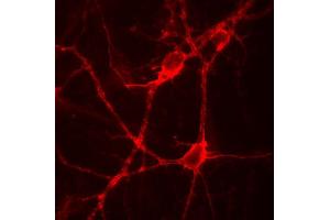 Indirect immunolabeling of PFA fixed rat hippocampus neurons. (Tenascin R antibody)