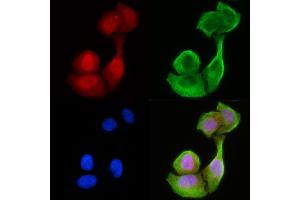 staining Hela cells(30 min of UV treatment) by IF/ICC. (CCDC99 antibody  (C-Term))