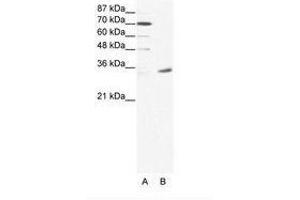 Image no. 1 for anti-Melanoma Antigen Family A, 9 (MAGEA9) (N-Term) antibody (ABIN202005) (MAGEA9 antibody  (N-Term))